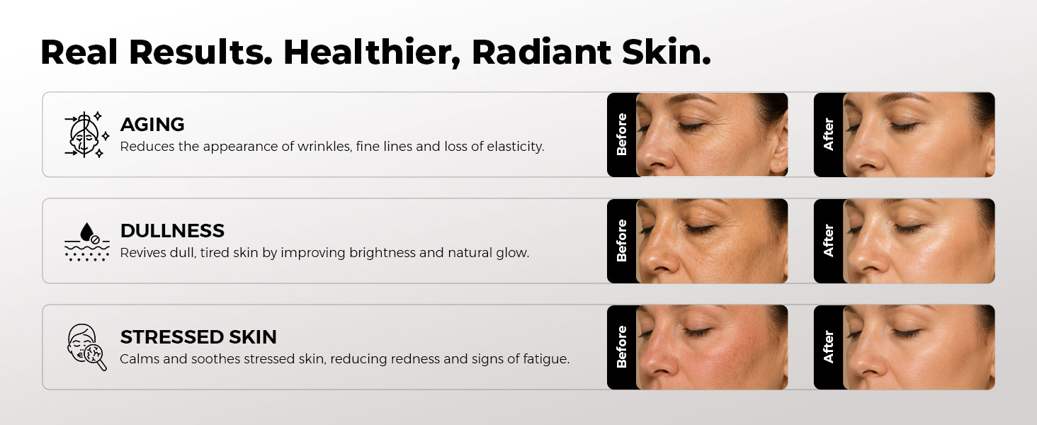 ghk-cu clinical trial skin wrinkles randomized double blind Deva Copper Peptide Serum -1oz regenerating Neovorin 50mg Injection - Size:600 ct. (120 servings)