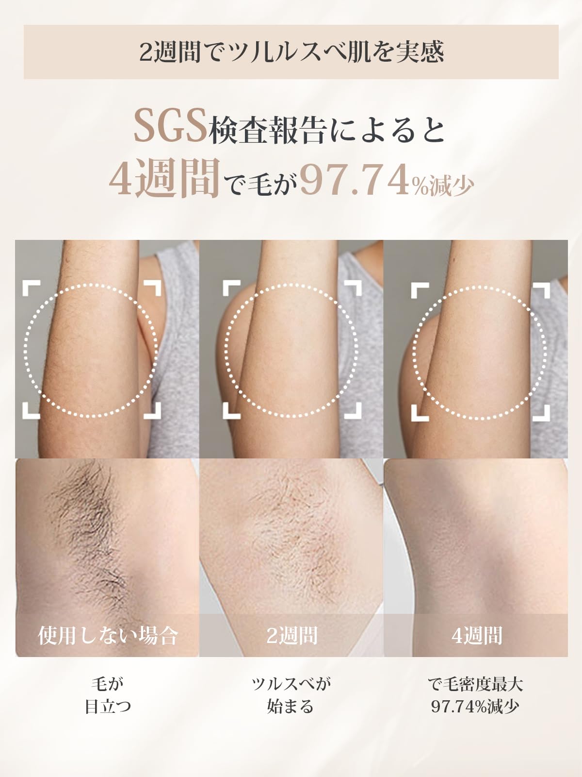 Amazon | Yete 脱毛器 アイスクリーム脱毛器 サファイア10℃冷感脱毛 4