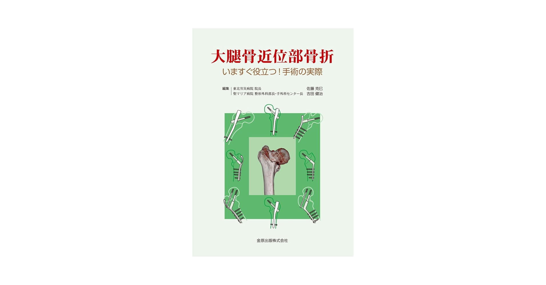 大腿骨近位部骨折 Surgical technique 裁断済み 大腿骨近位部骨折: いますぐ役立つ! 手術の実際 | 佐藤克巳