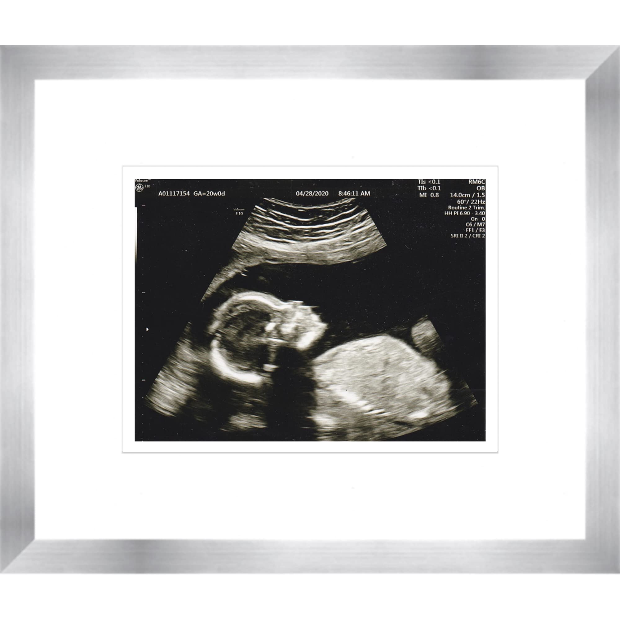 Silver Sonogram Frame with White on White Double Mats