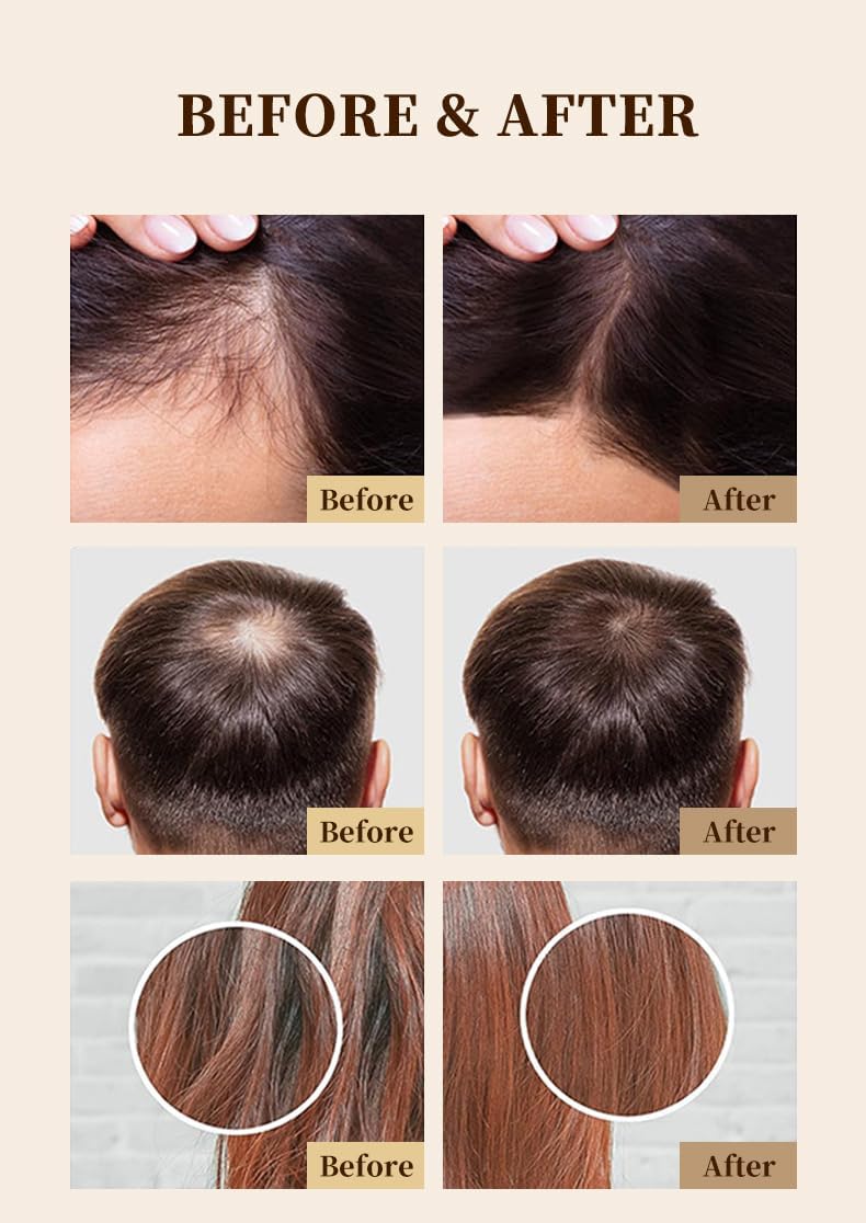 AFRI PURE Miracle Hair Growth Oil 50 ml