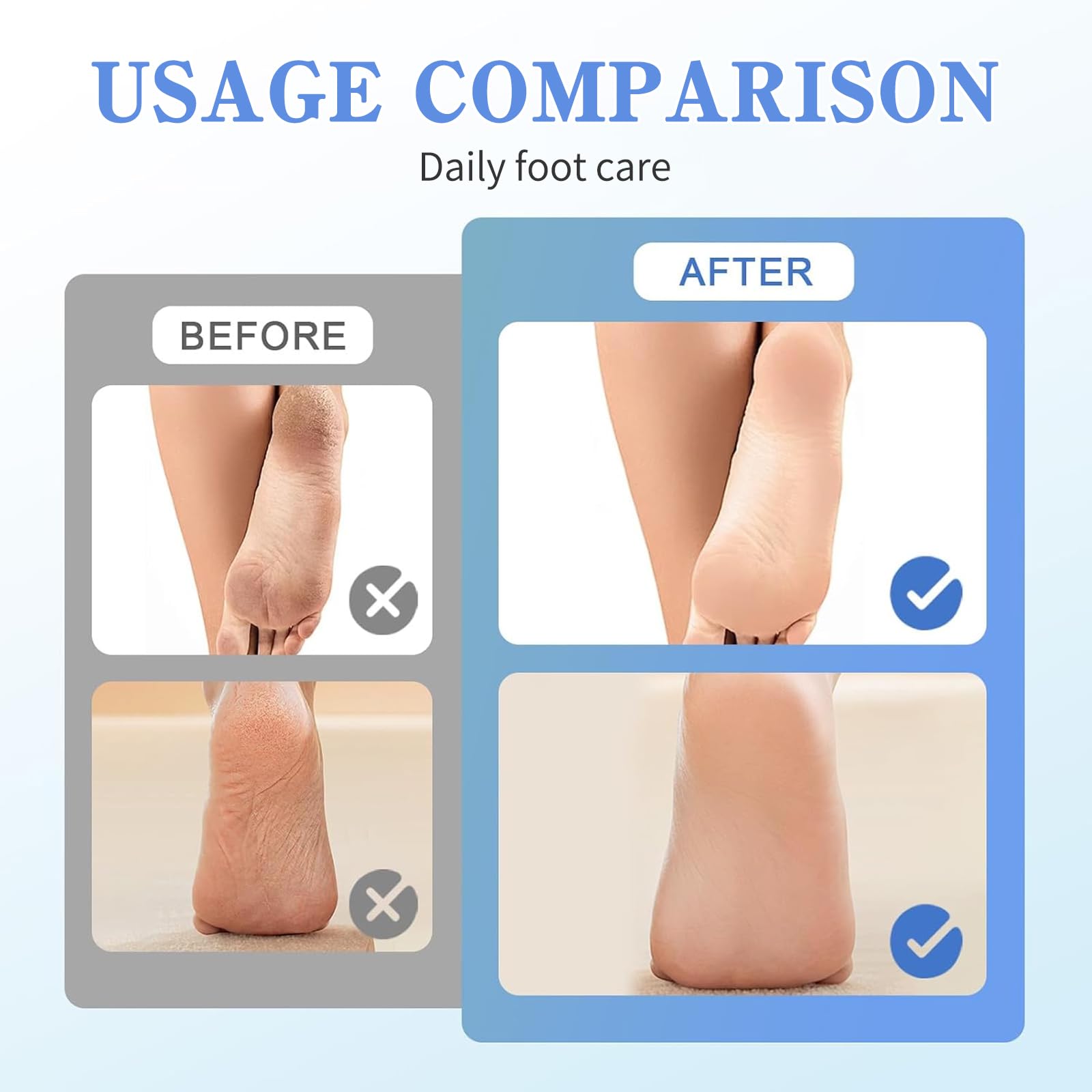 Pedicure Elettrico Professionale, Attrezzi per Cura dei Piedi, piede Velocità Regolabile, Rimuovi Calli Elettrico, Pedicure per Calli Rimozione, per Pelle