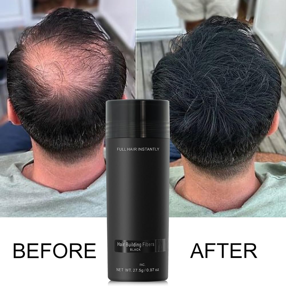 Hair Building Fibers - Natural Fibres for Men & Women, Waterproof & Instant Hair Loss Concealer - Black, 30 g (Pack of 1) - Image 2