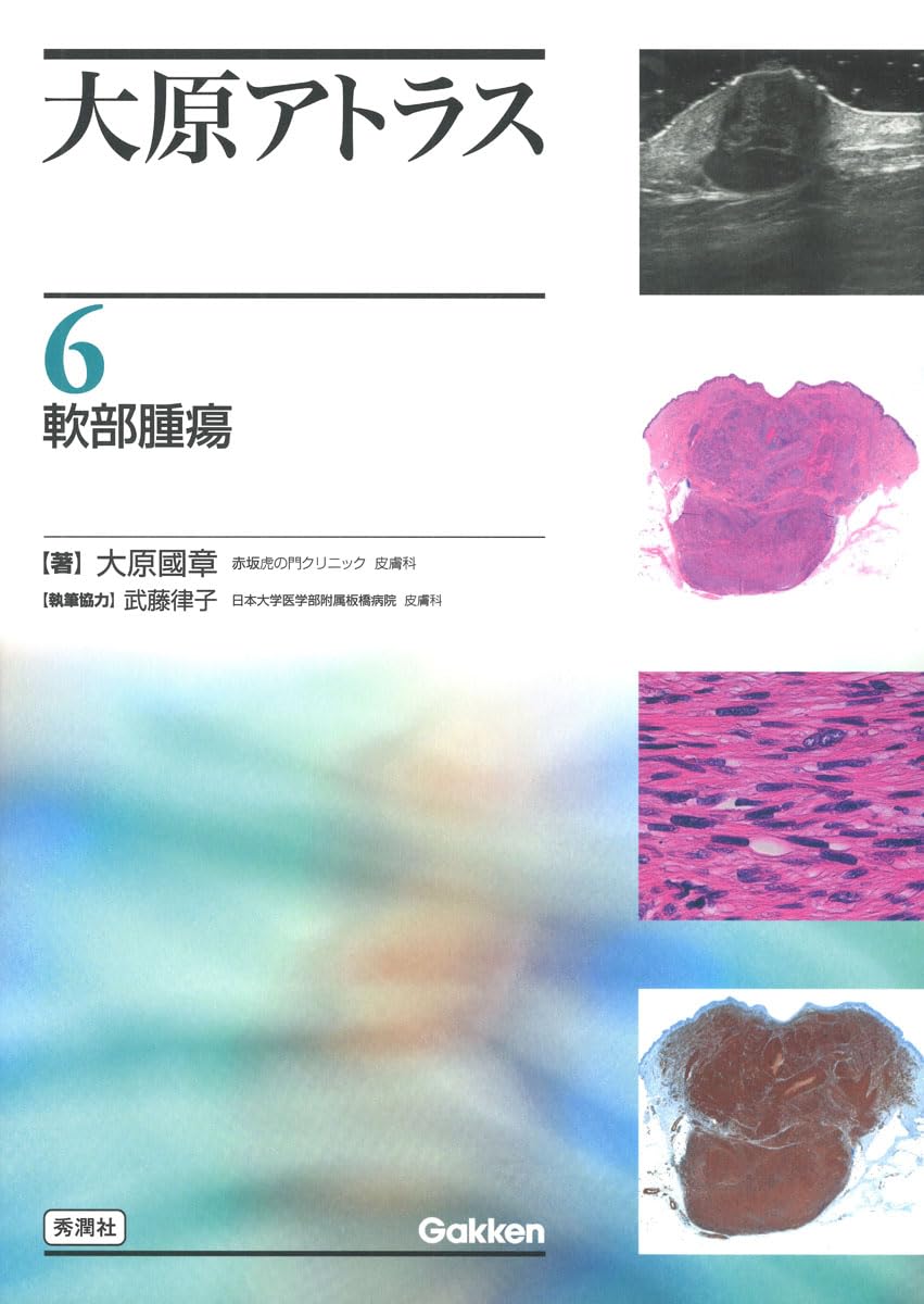 Amazon.co.jp: 大原アトラス 6 軟部腫瘍 : 大原 國章: 本