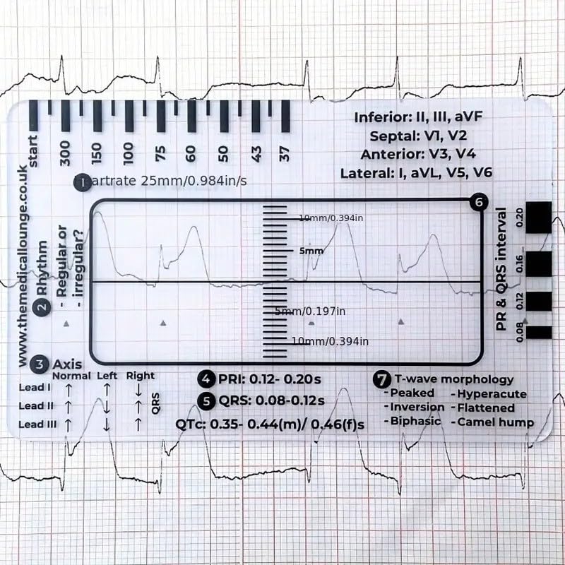 Tarjeta de regla de ECG médica, herramienta de medición profesional para el cuidado de la salud, guía de análisis de frecuencia cardíaca y QRS