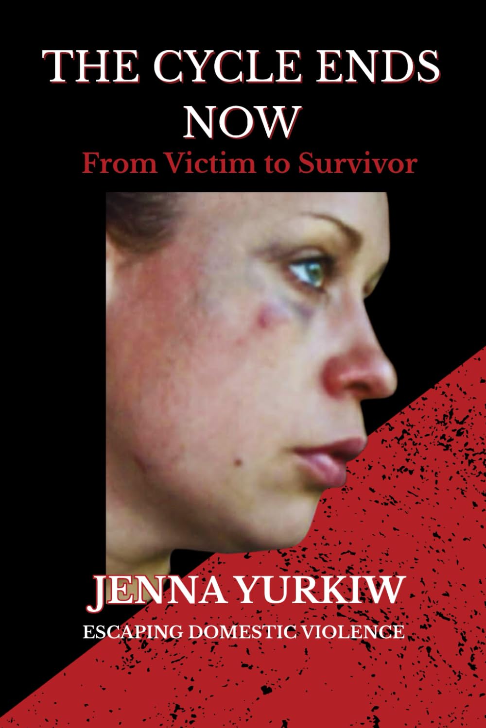 The Cycle Ends Now: From Victim to Survivor - Escaping Domestic Violence