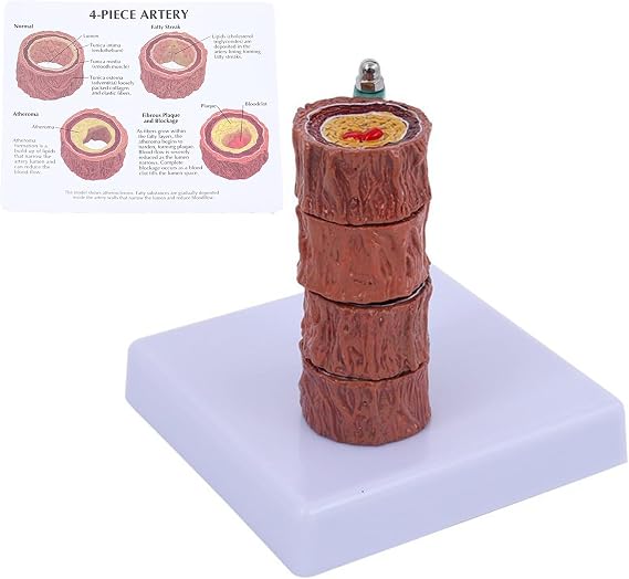 4-Piece Artery Model with Detachable Base, Realistic Human Artery Blood Vessel Anatomy Model, Arteriosclerosis Teaching Tool for Anatomy and Physiology Education