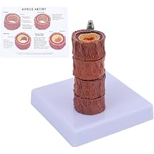 4-Piece Artery Model with Detachable Base, Realistic Human Artery Blood Vessel Anatomy Model, Arteriosclerosis Teaching Tool for Anatomy and Physiology Education