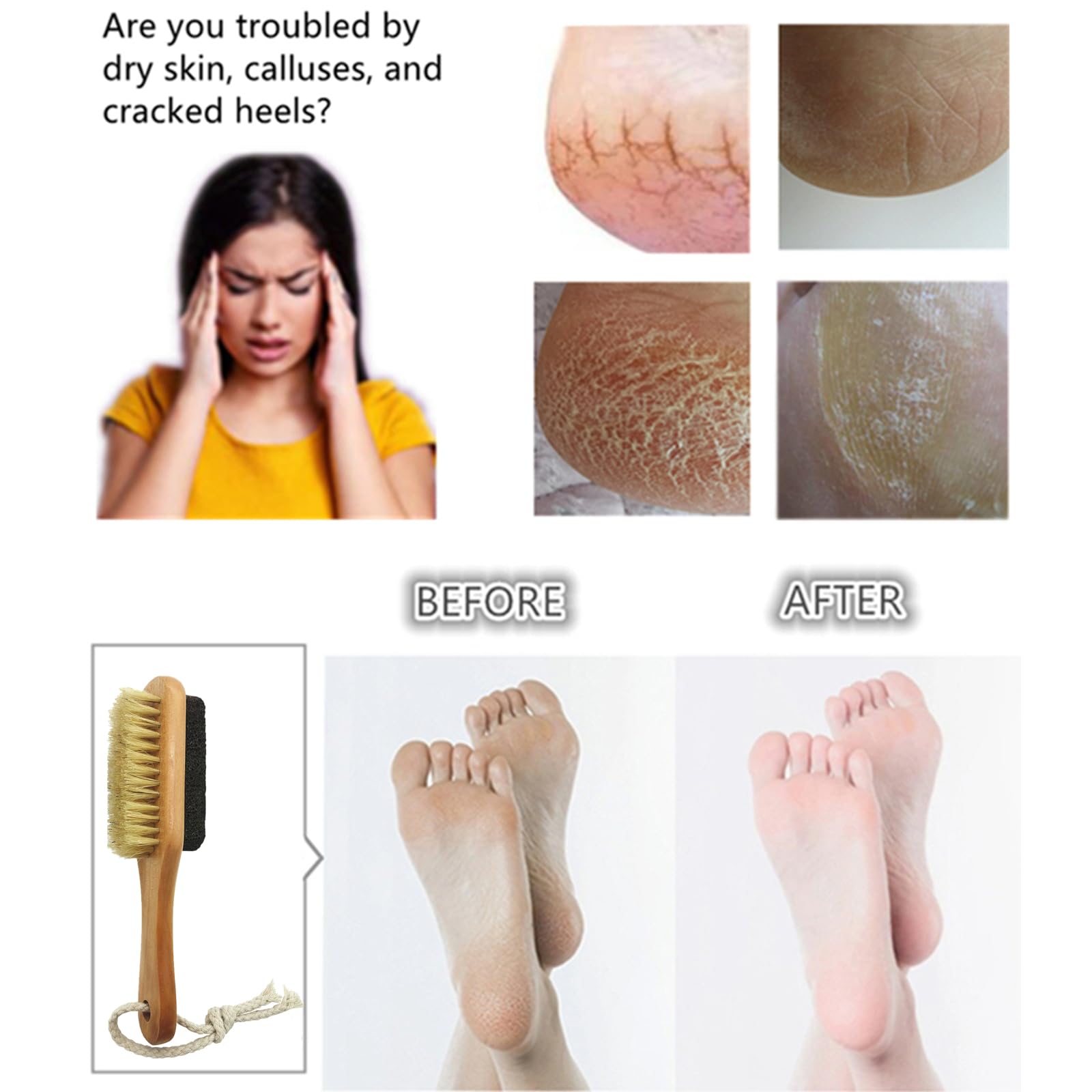 Piedra pómez de lava natural para pies con cepillo, removedor de callos, exfoliante, herramientas de pedicura para piel muerta dura, pies más suaves y lisos, cerdas de jabalí de doble cara