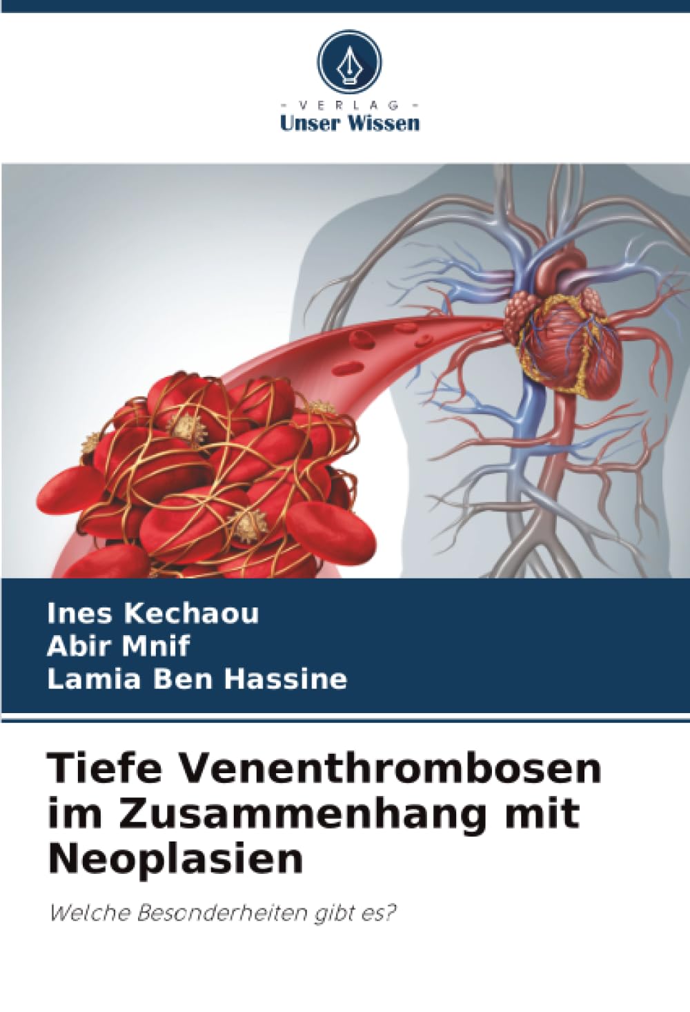 Tiefe Venenthrombosen im Zusammenhang mit Neoplasien: Welche Besonderheiten gibt es?