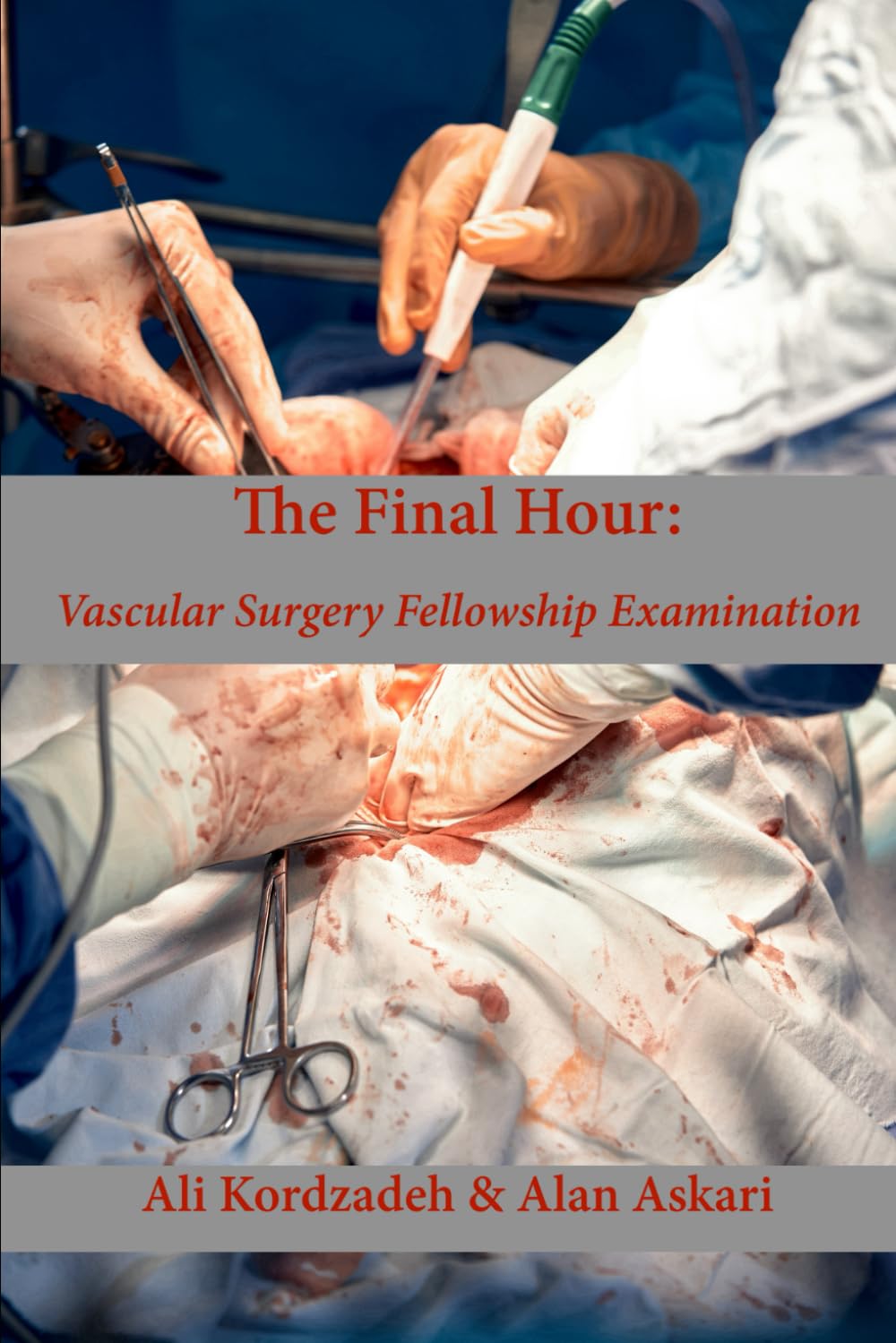 The Final Hour: Vascular Surgery Fellowship Examination: Vascular Surgery