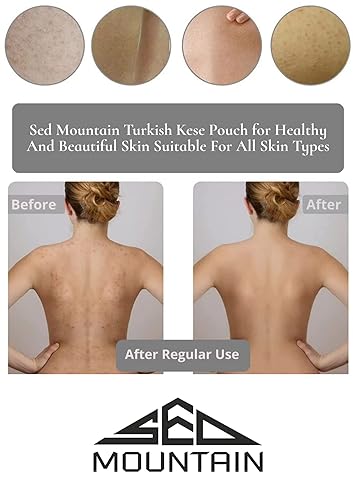 Miniatura 2 de Sed Mountain Hamam turco Kese Dead - Exfoliante corporal para el cuidado de la piel, guante corporal exfoliante en casa, microdermoabrasión,