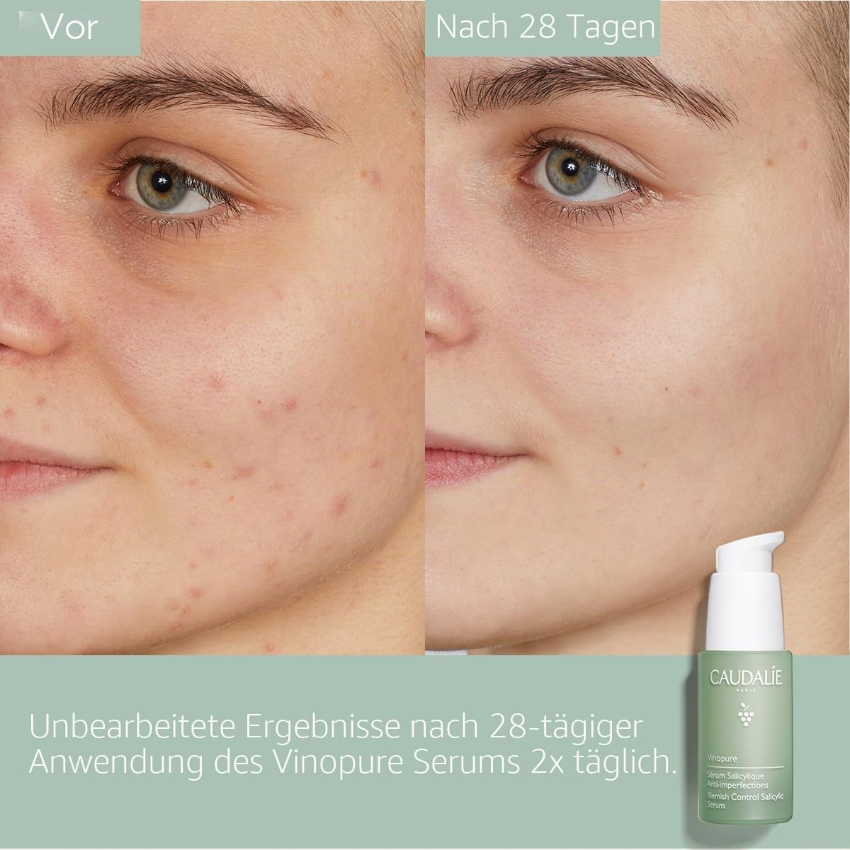 Caudalie Vinopure Serum mit Salicylsäure gegen Unreinheiten – 30 ml