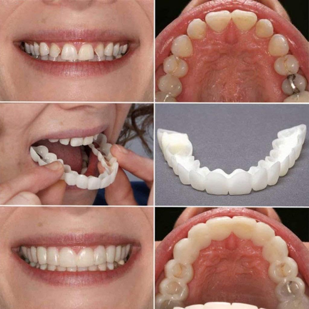 HEVIR Snap-On Instant Perfect Smile Veneers for Top & Bottom Teeth | Comfort Fit Flex Dentures | White Tooth Cosmetic Cover | Reusable Teeth Veneer for a Natural Looking, Neat, Confident Smile 2
