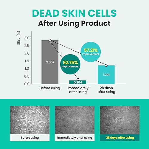 Miniatura 4 de Real Barrier Porebium Waterlock Essence 3.7 fl oz, 3.71 onzas líquidas, limpiador acuoso de poros, pelado de células muertas de la piel para pieles