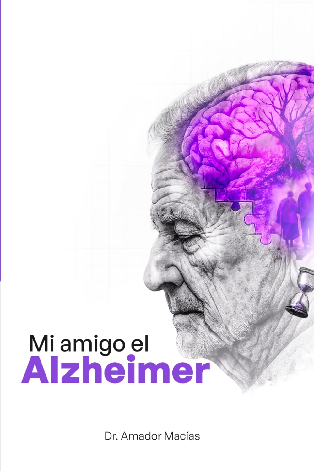 MI AMIGO EL ALZHEIMER