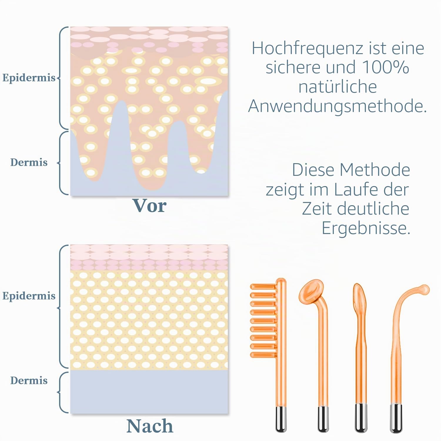 TUMAKOU Hochfrequenzstab Gesicht Hauttherapiegerät mit 4 Neon Stab Aknebehandlung Hautstraffung Faltenreduzierung