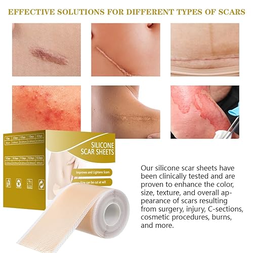 Miniatura 4 de Hojas de silicona para cicatrices, cinta para cicatrices quirúrgicas de 2 pulgadas x 118 pulgadas, parches de silicona para tratamiento de