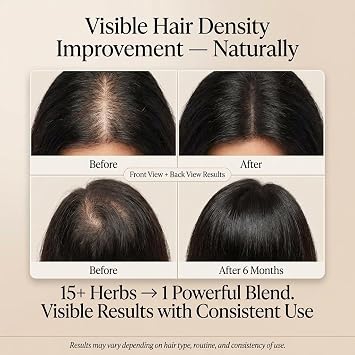 Moringa Rosemary Hair Oil with Amla, Bhringaraj, Pumpkin seed, Almond, Neem, Fenugreek, Infused with Biotin & Vitamin E, Reduces Hair Fall & Thinning, Supports Growth & Scalp Nourishment, Made in USA