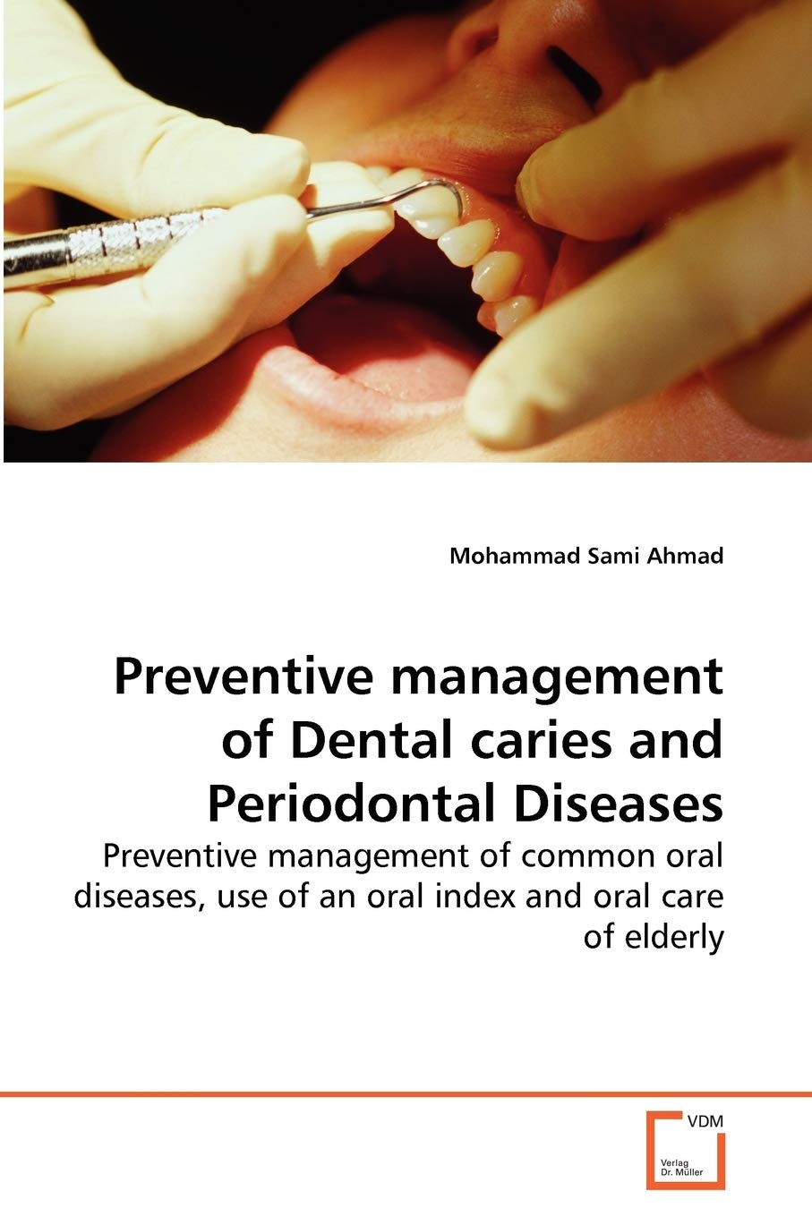 Buy Preventive management of Dental caries and Periodontal Diseases