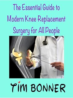 The Essential Guide to Modern Knee Surgery for All People.