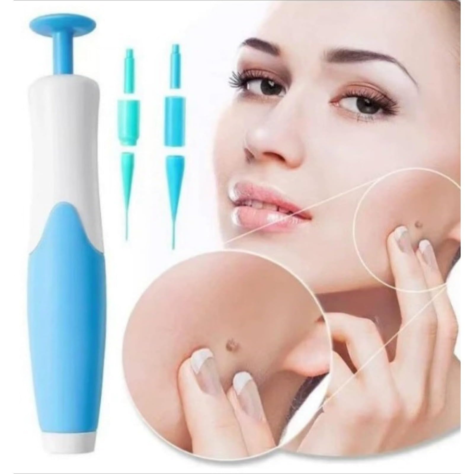 DermaSkin Pro – Kit correcteur cutané, adieu acrochordons, soin indolore à domicile (1 Kit)