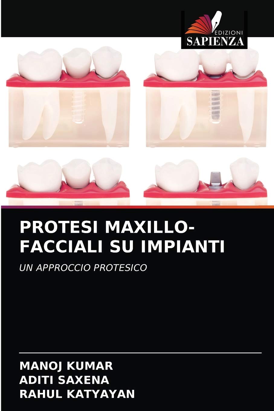 PROTESI MAXILLO-FACCIALI SU IMPIANTI