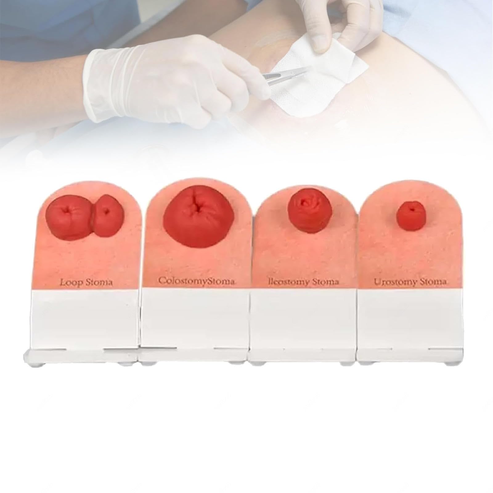 Ostomy Care Training Model (4 Pieces), Stoma Nursing Simulator, Wound Models for Practice Students Medicine, Realistic Manikin
