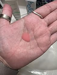 노화 방지 혈청