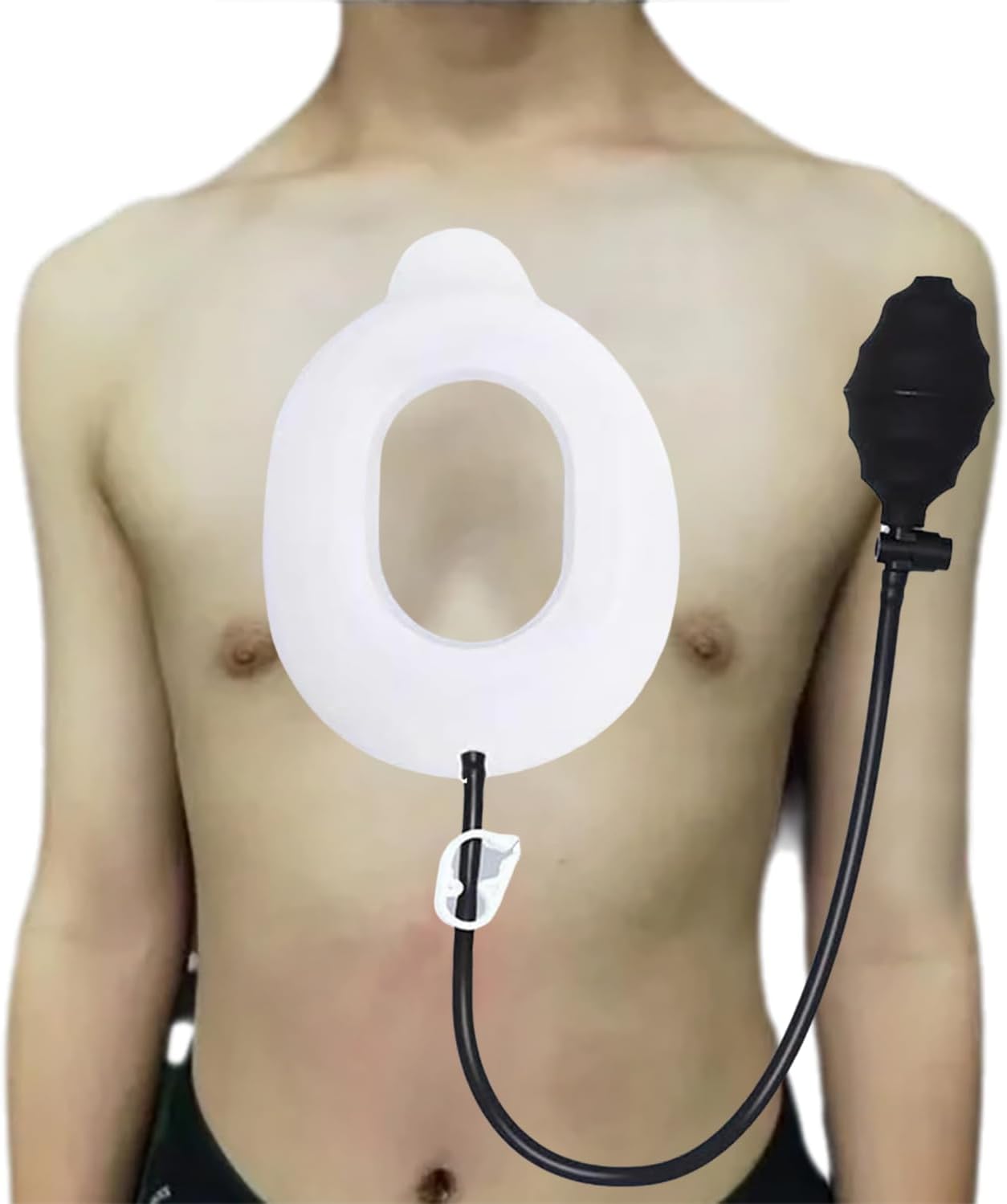 Pectus Excavatum Vacuum Bell, Orthosis Brace for Sunken Chest Correction, Sternal Depression Support, Physical Chest Correction of Pectus Excavatum for Adults and Child L
