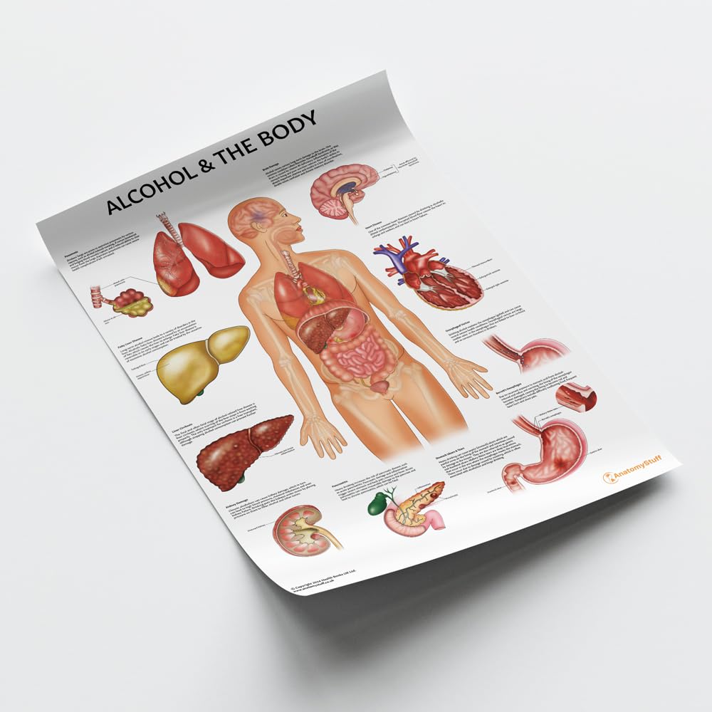 Poster "Alcohol and The Body", 45 x 60 cm, menschliche Anatomie, anatomisches Poster für Bildung, Lernen und Studenten, Alkoholeffekte auf den menschlichen Körper, Pathologie-Poster