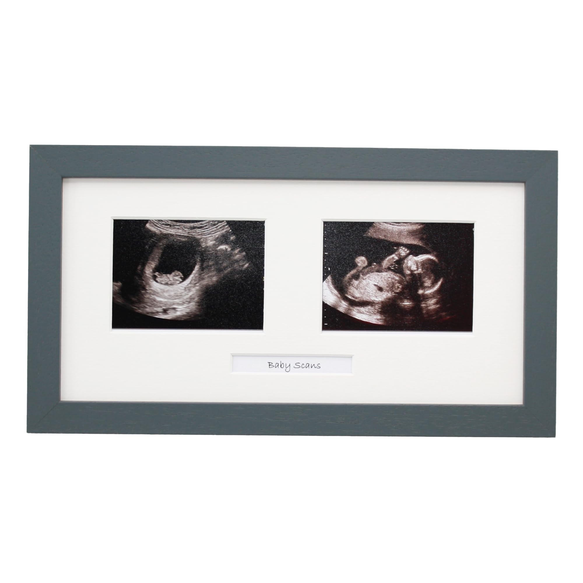 Baby Scan Photo Frame. Optional Personalisation. Multi Aperture Frame to display Two Ultra sound photographs. Pregnancy announcment | Baby Shower | Pregnancy Keepsake (Dark Grey Frame)