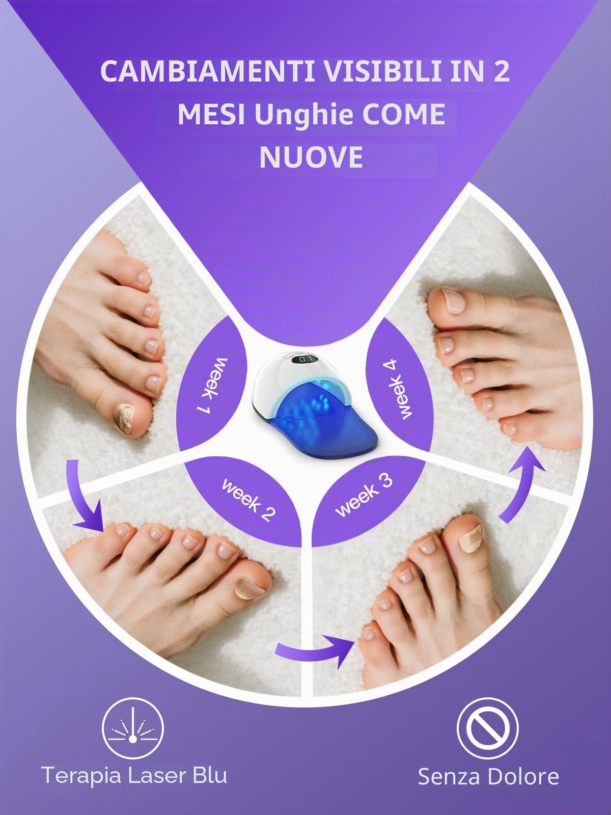 iKeener Aggiornamento laser per funghi delle unghie per dita delle mani e dei piedi, sessioni regolabili 5/7/10 minuti, laser per la pulizia delle unghie e onicomicosi, rimozione funghi delle unghie