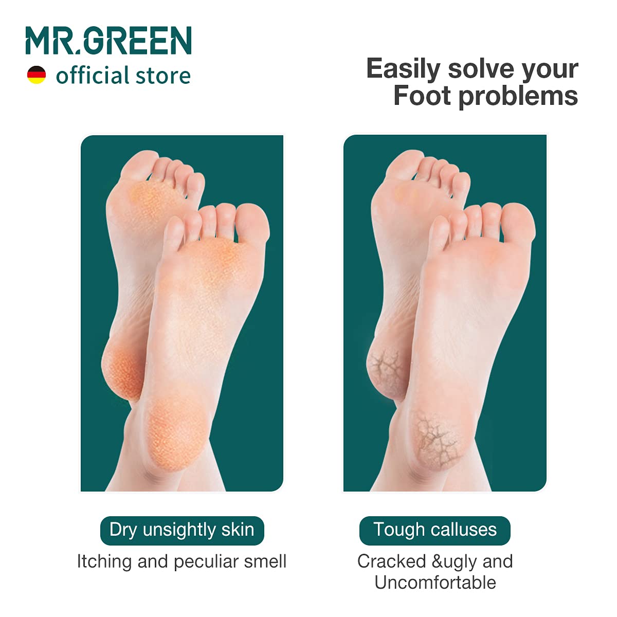 MR.GREEN Foot File for Hard Skin and Calluses Foot File Double Sided Professional Stainless Steel Pedicure Foot Care Tool Foot Scraper (Red) - Image 3