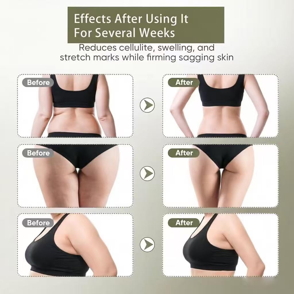 Lymphatic Drainage Massager & Anti Cellulite Massage Tool, Helps Reduce Stretch Marks & Cellulite, for Legs, Arms & Belly, Body Sculpting Machine with Microcurrent, Light, Heat & Vibration image 5