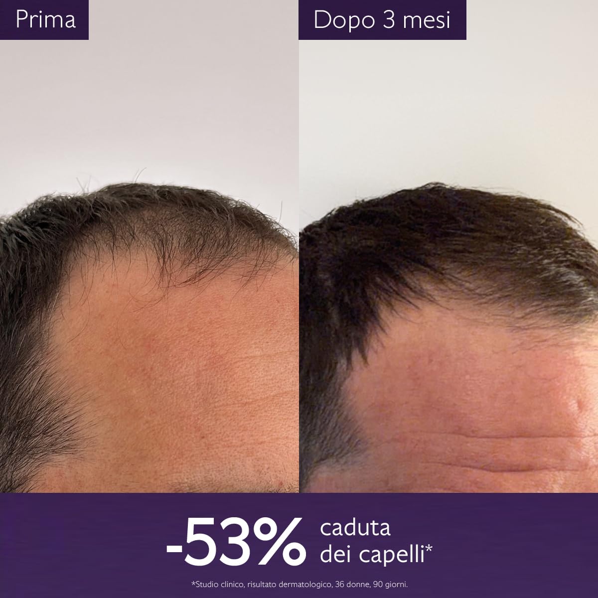 Caudalie Siero Capelli Anticaduta & Shampoo Ridensificante e Volumizzante, 50ml + 200ml