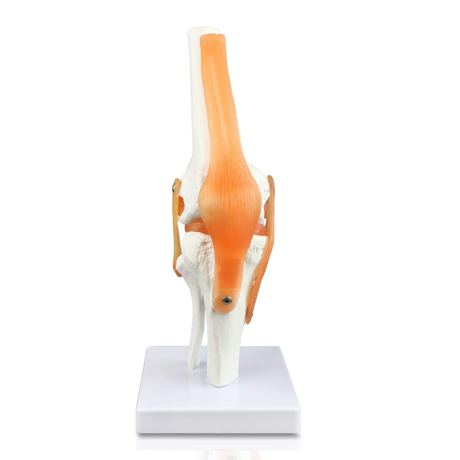Vision Scientific VAJ212 Classic Functional Knee Joint, Articulate with Life-Like Synthetic Ligaments, Duplicating Half of Femur, Patella, Proximal Tibia and Fibula