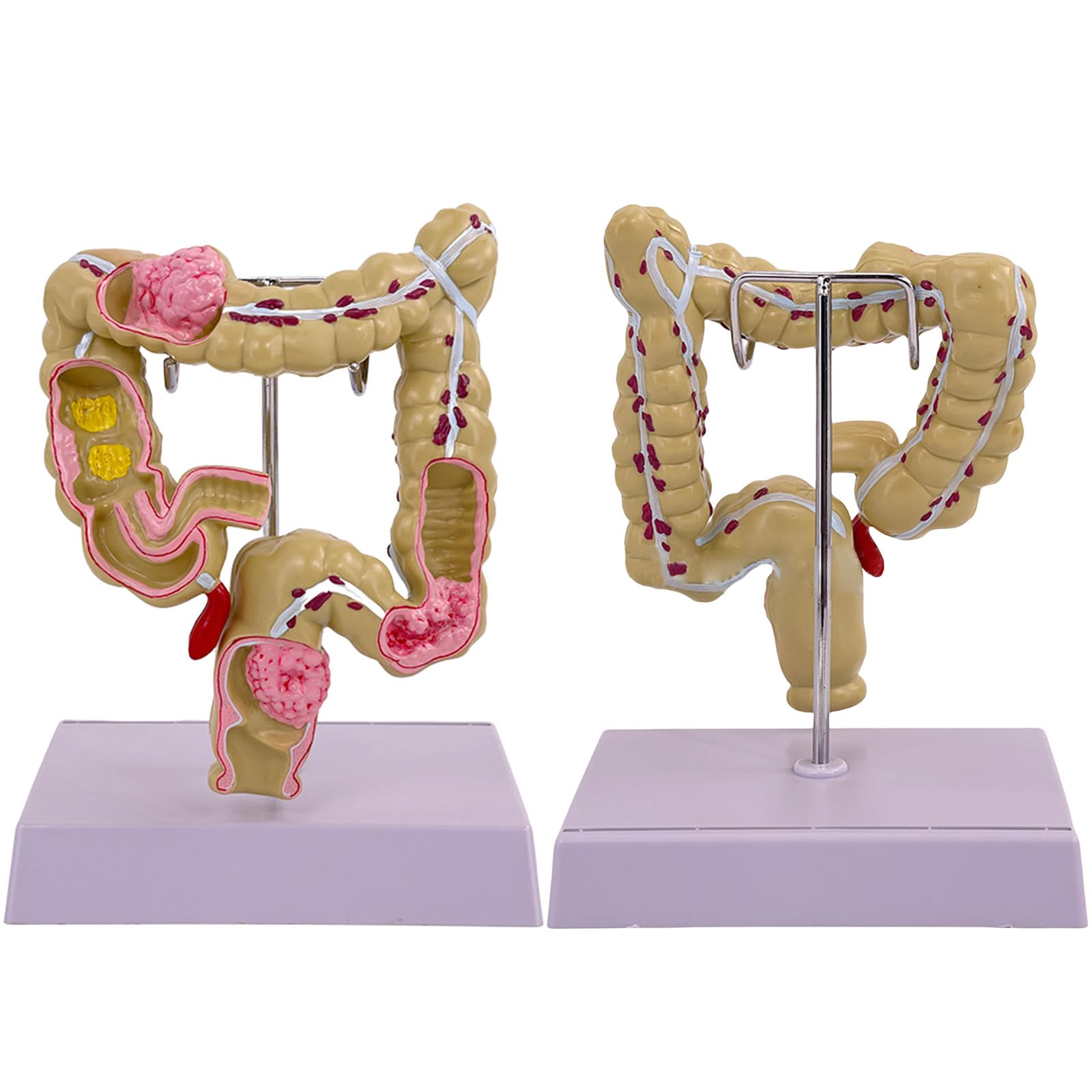 Modello umano dell'intestino crasso Patologie umane del modello dell'intestino crasso Strumento didattico per studi scolastici di laboratorio Patologie del modello dell'intestino crasso Modello di