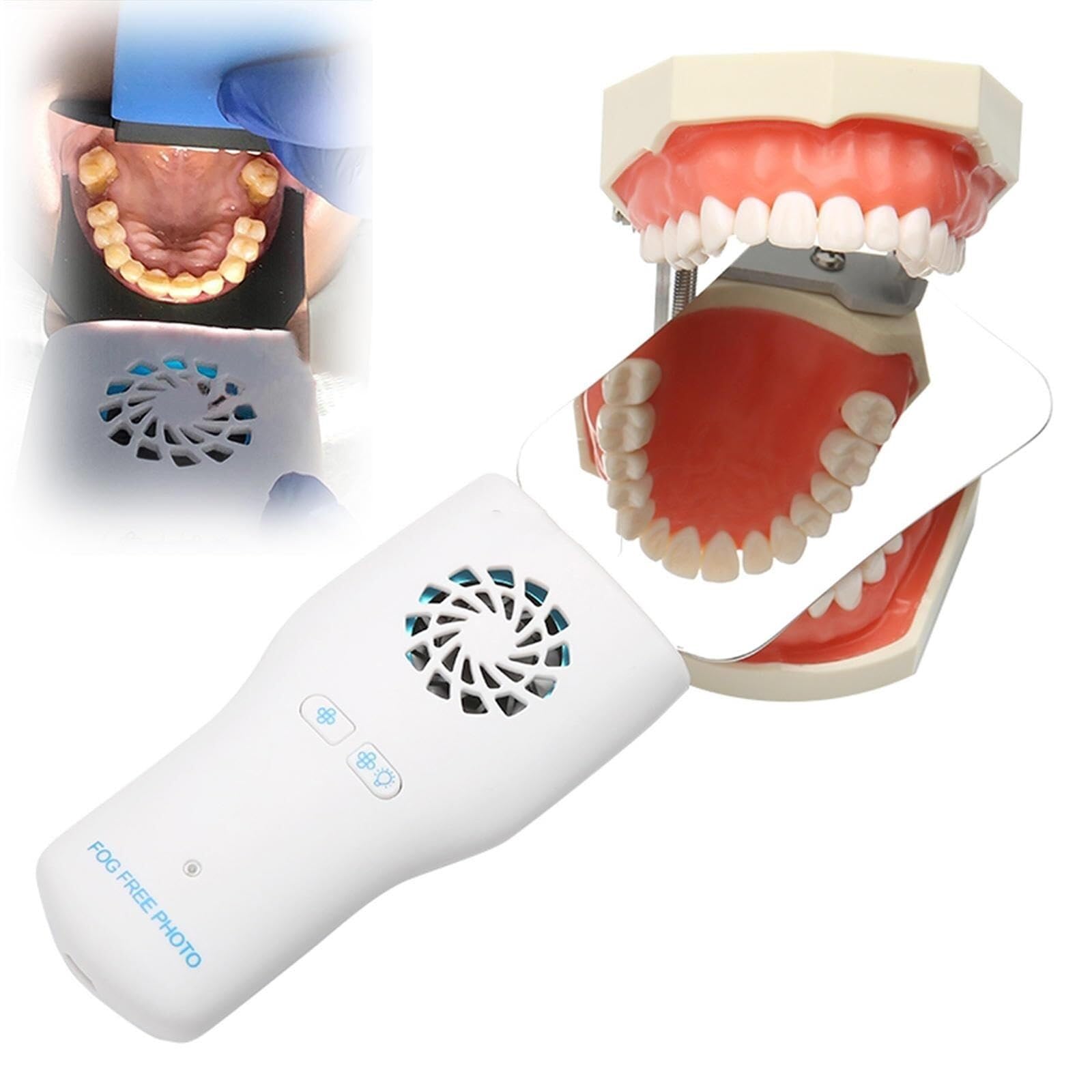 Réflecteur de Miroir orthodontique Dentaire, Miroir de Photographie Dentaire Anti-buée avec 4 miroirs interchangeables Examen des Dents Intra-orales Miroir LED sans Fil