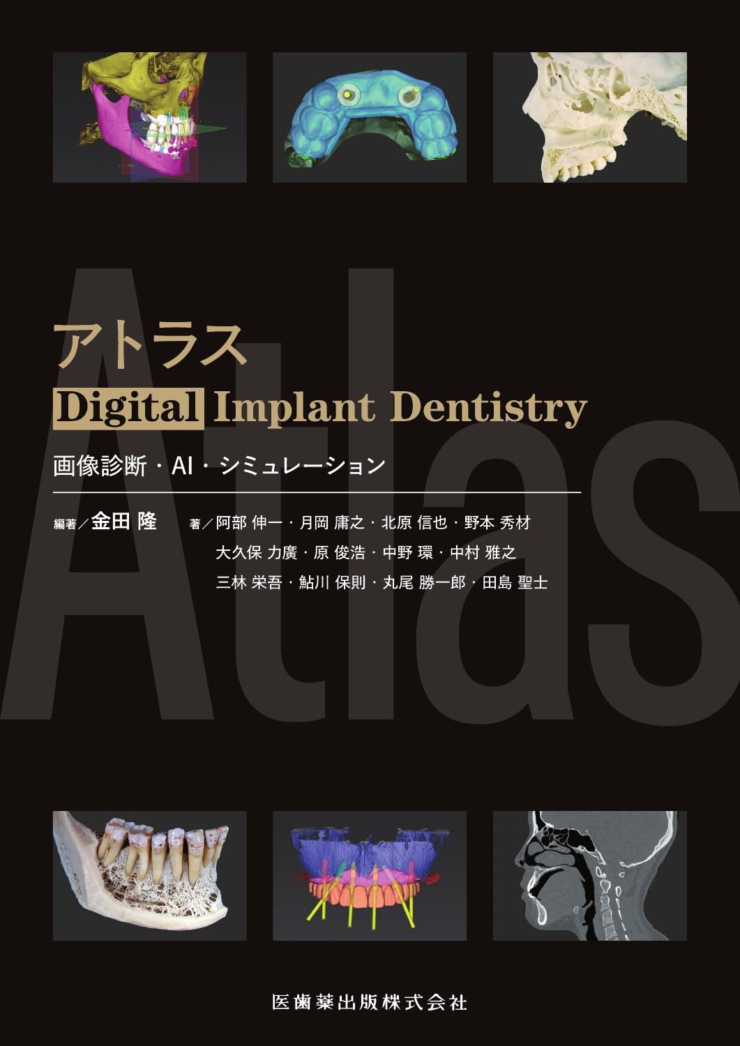アトラスDigital Implant Dentistry: 画像診断・AI・シミュレーション