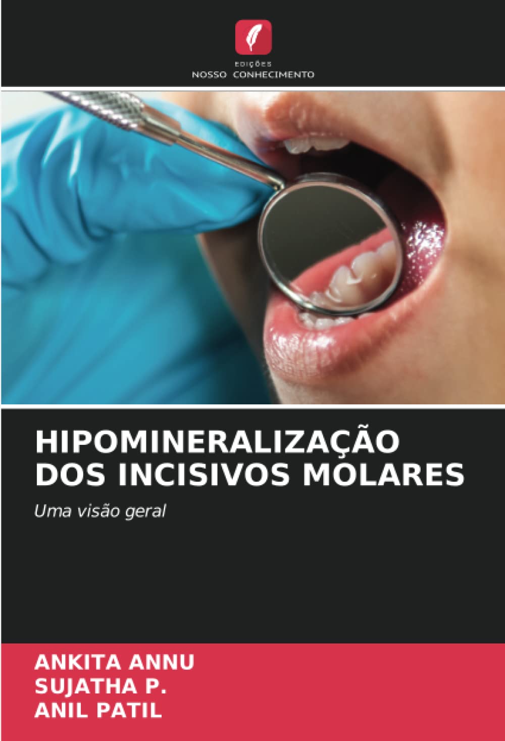 HIPOMINERALIZAÇÃO DOS INCISIVOS MOLARES: Uma visão geral (Portuguese Edition)