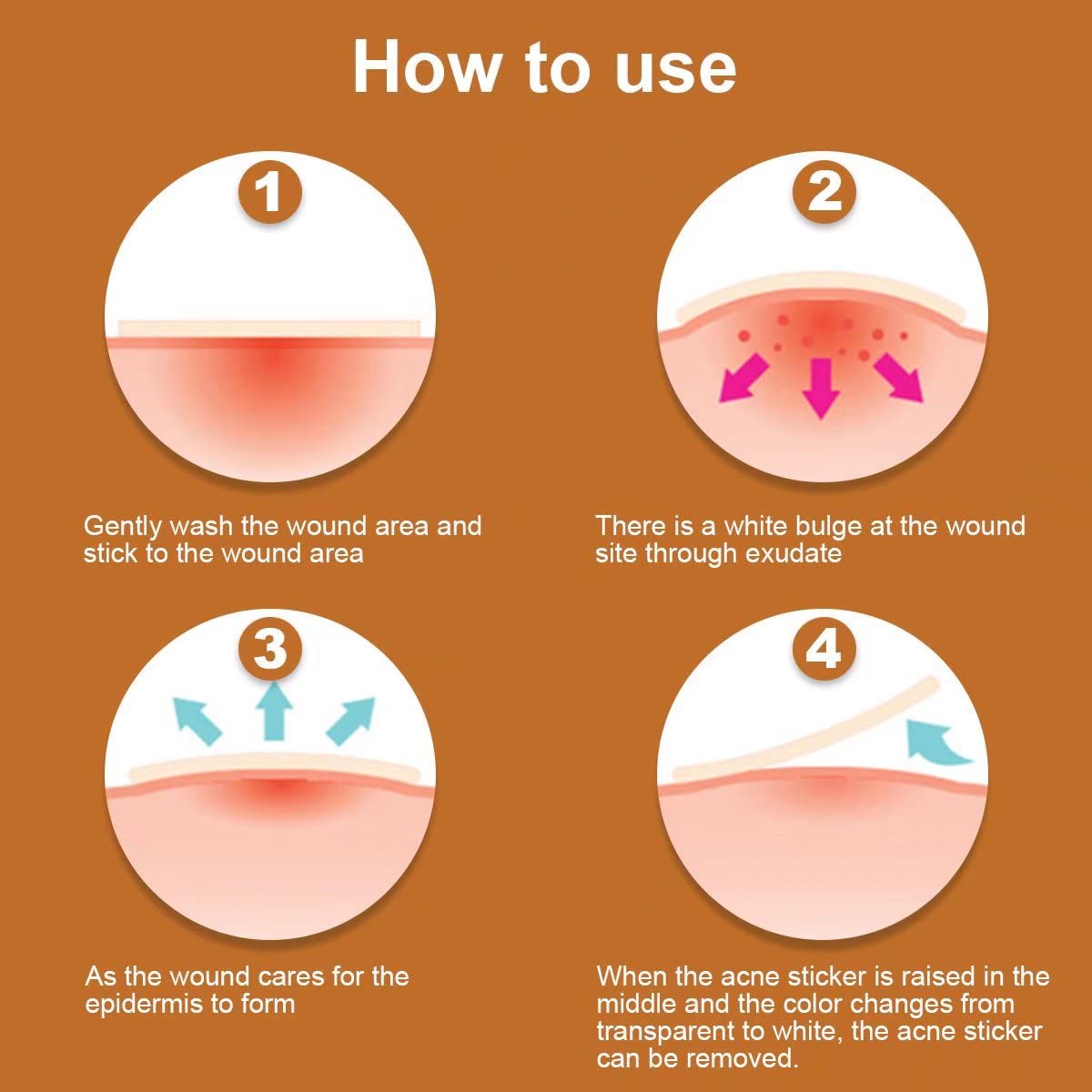 Layla and Dawn Acne Pimple Healing Patch - Absorbing Cover, Invisible, Blemish Spot, Hydrocolloid, Skin Treatment, Facial Stickers - 33 Patches, Size 10mm & 12mm : Beauty & Personal Care