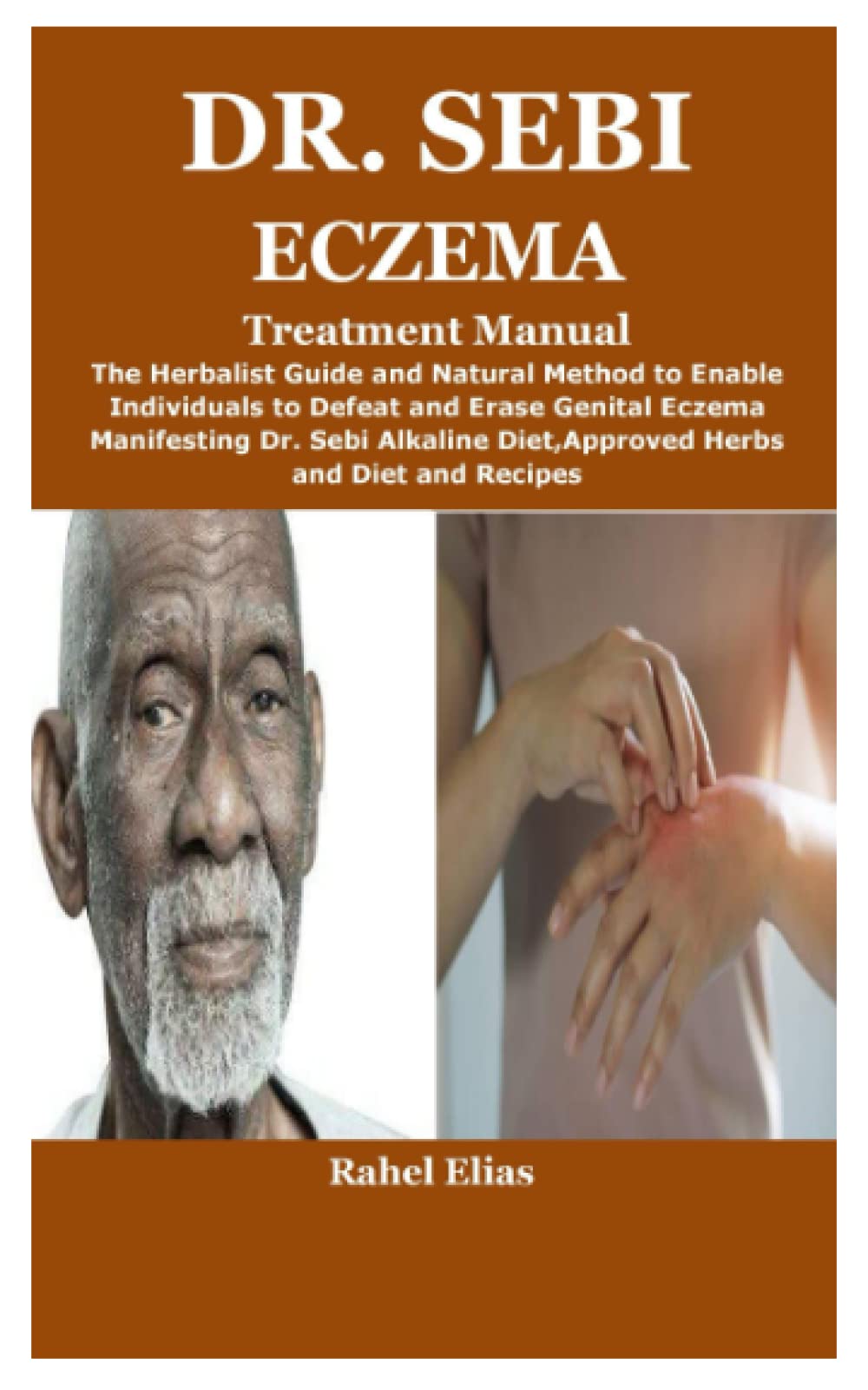Buy Dr. Sebi Eczema Manual The alist Guide and Natural Method to