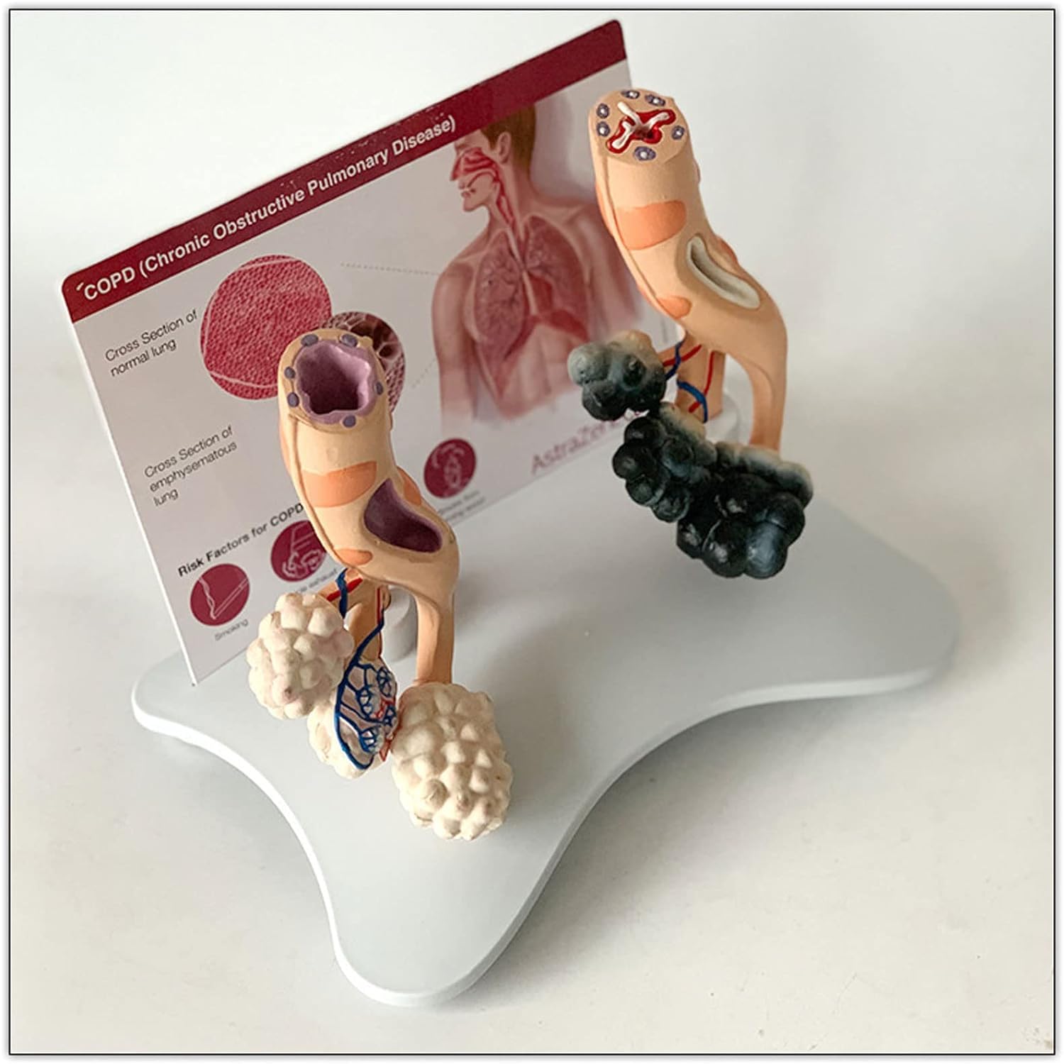 Modèle alvéolaire de la santé pulmonaire chez le fumeur, modèle de poumon sain, avec caractéristiques pathologiques et structure anatomique précise pour les effets du tabagisme sur la santé pulmonaire