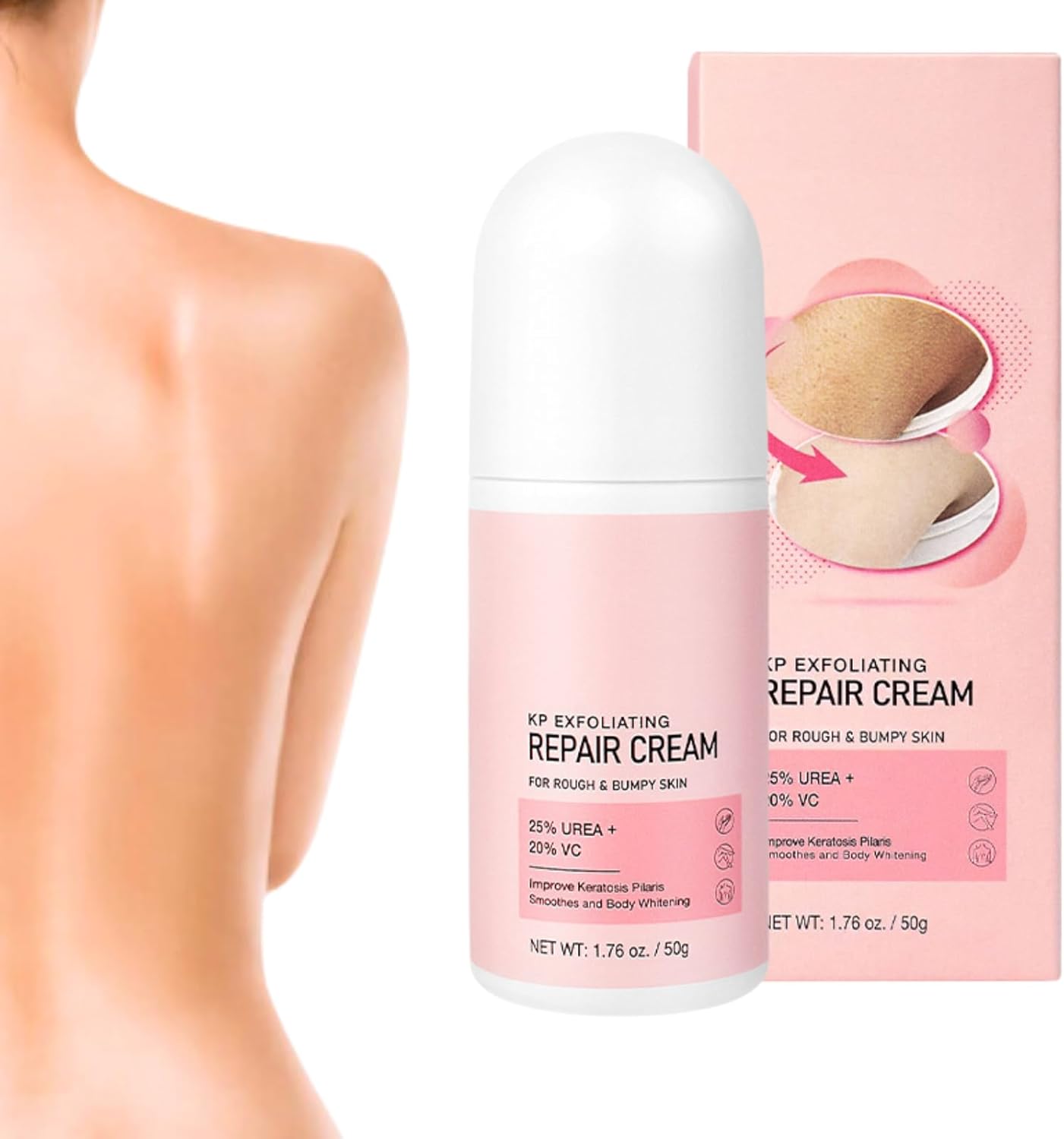 Keratosis Pilaris Improvement Body Cream – Body Moisturiser – Body Creams for Women – Firming Body Lotion for Soothing and Repairing – Dry Skin Moisturiser for Skincare – Nourishing & Moisturing