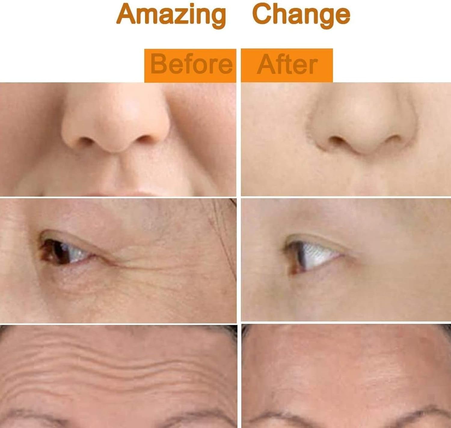 Abgrow 2 in 1 Energy Beauty Bar Electric Vibration Facial Massage V shape Roller Waterproof Face Skin Care T-Shaped Anti Wrinkle Massager for Forehead Cheek Neck Clavicle Arm (Gold Colour) 6 61VTNwepBbL. SL1500