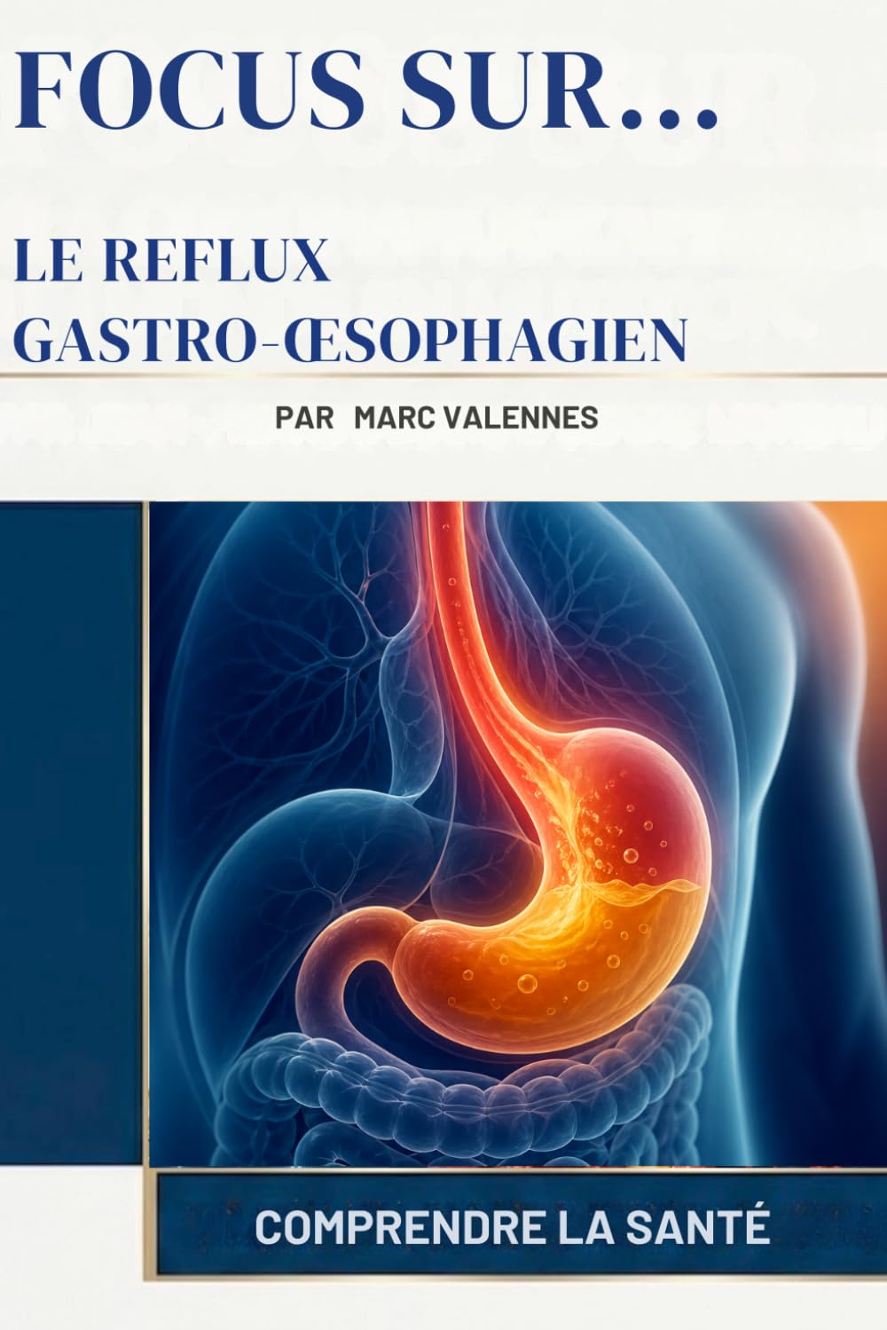 Le Reflux Gastro-œsophagien (Focus Sur...)