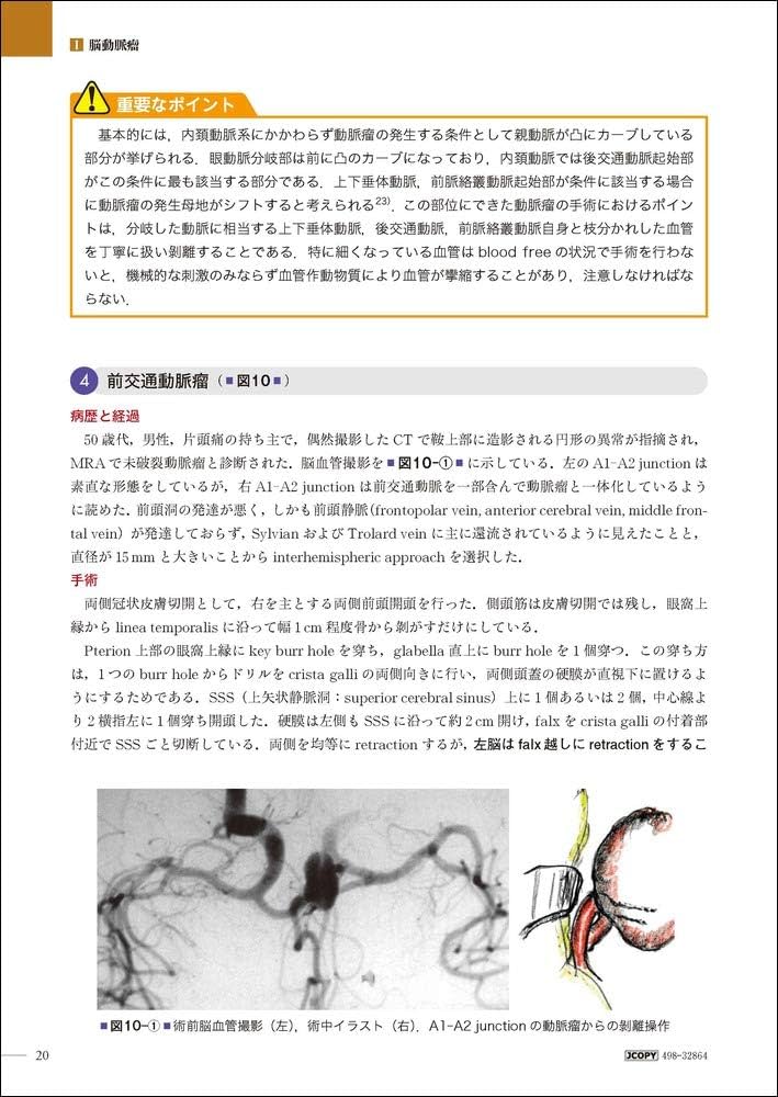 脳神経外科手術 私のアプローチ | 松居 徹 |本 | 通販 | Amazon