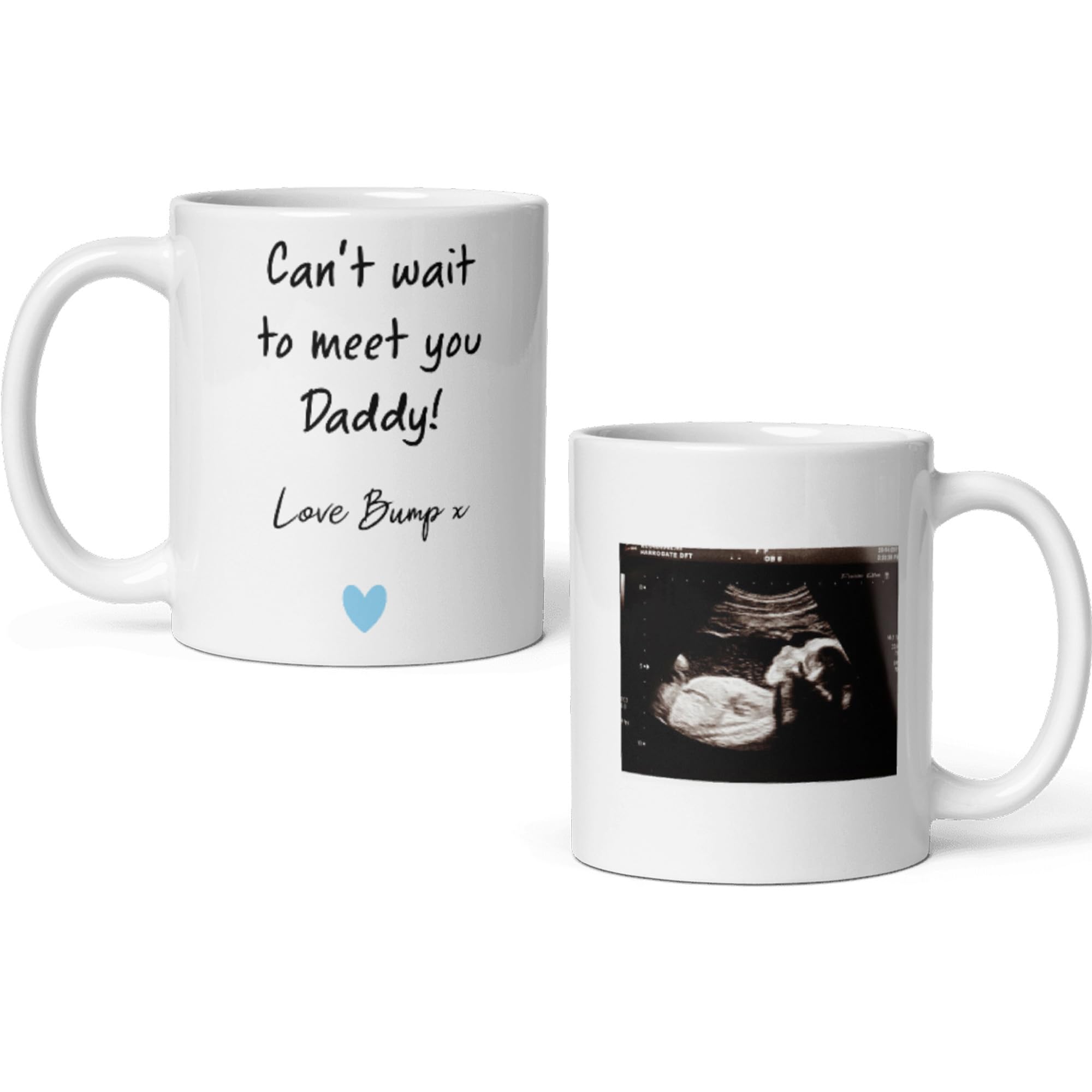Confidently Quirky - Personalised Daddy Baby Scan White Mug, Daddy to Be Gift โ image 1