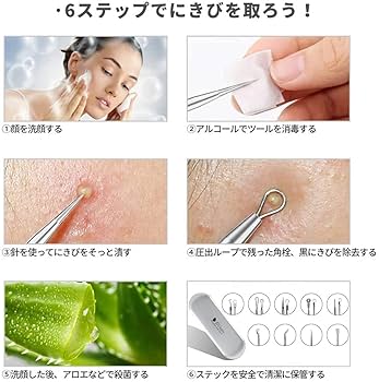 Amazon｜GXJHZY 角栓取り ピンセット 汎用型ピンセット 精密